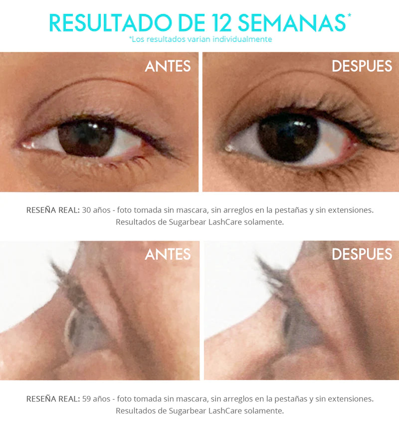 LashCare Serum para pestañas + Cepillo Gratis